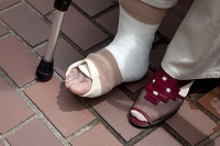 Crutches May Aid a Broken Foot