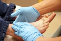 Foot Care Tips for Diabetic Patients